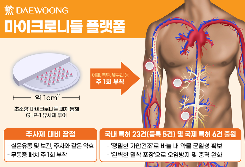 마이크로니들 혈당 패치